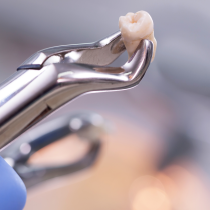 A tooth in a set of pliers